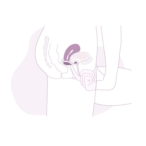 portfolio-contraception-notice-05-studio-polette-graphiste-strasbourg